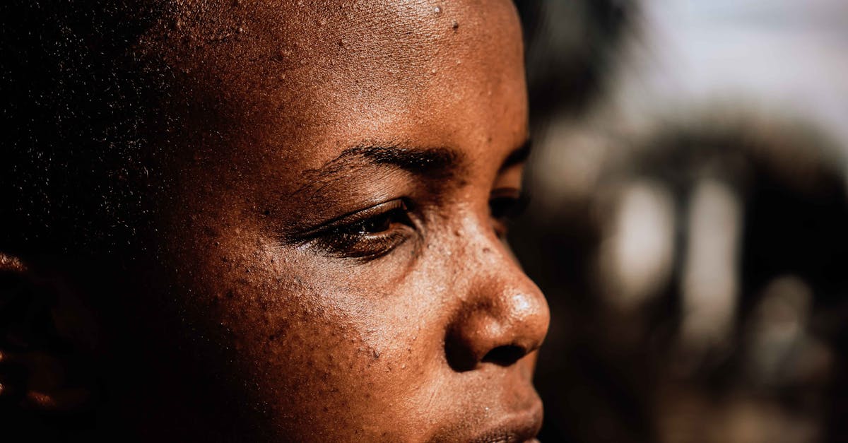 Ashwagandha for Skin: A Clinical Guide to Dosage, Mechanism, and Outcomes