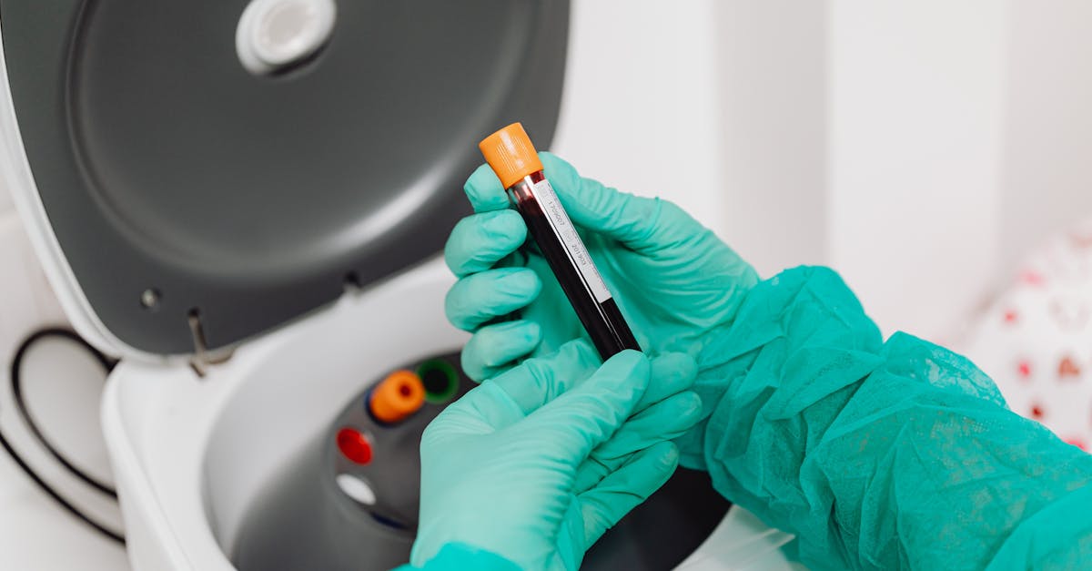 Taking Benfotiamine? Side Effects Start With Your Labs