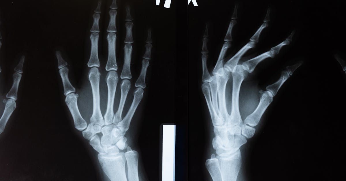 Best Collagen for Joints: A Clinical Guide to Dosage, Mechanism, and Outcomes