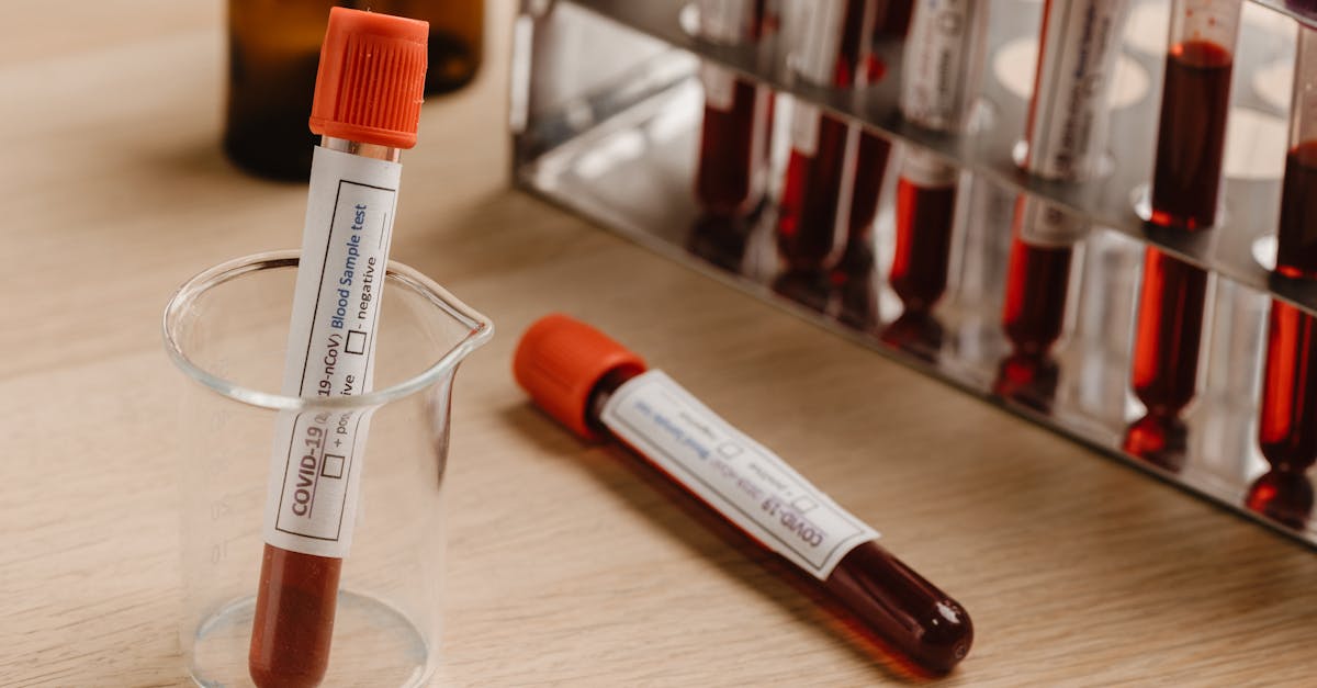Lycopene Turning Your Skin Orange? Here's What's Really Going On