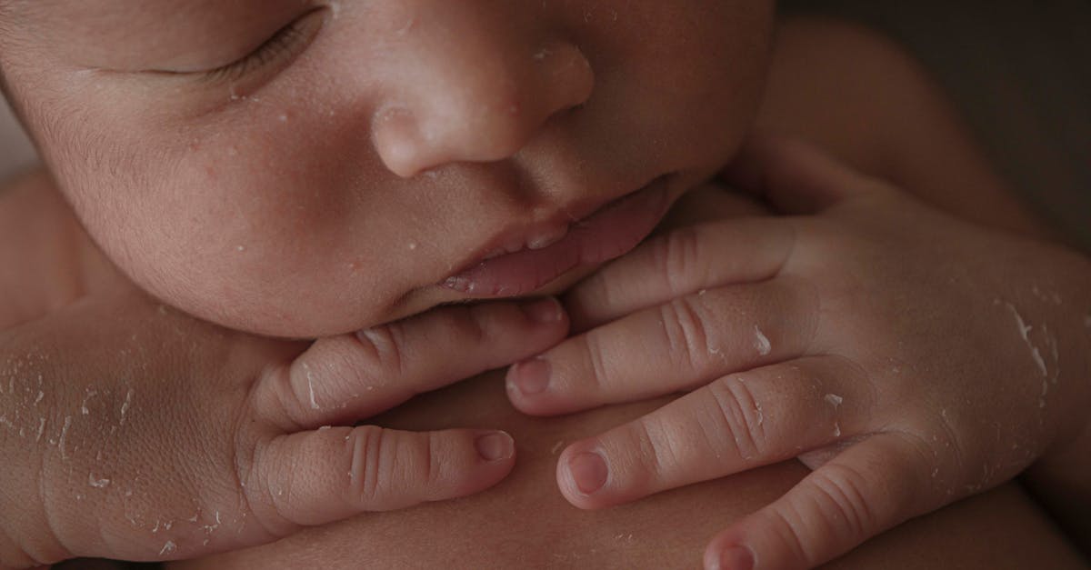 Melatonin for Skin: Who Actually Benefits — and Who Should Skip It
