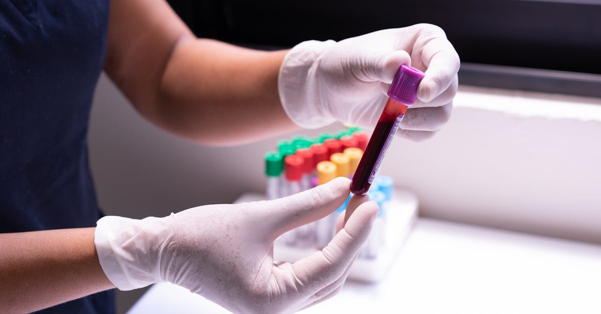 Phosphatidylcholine Side Effects No One Warns You About