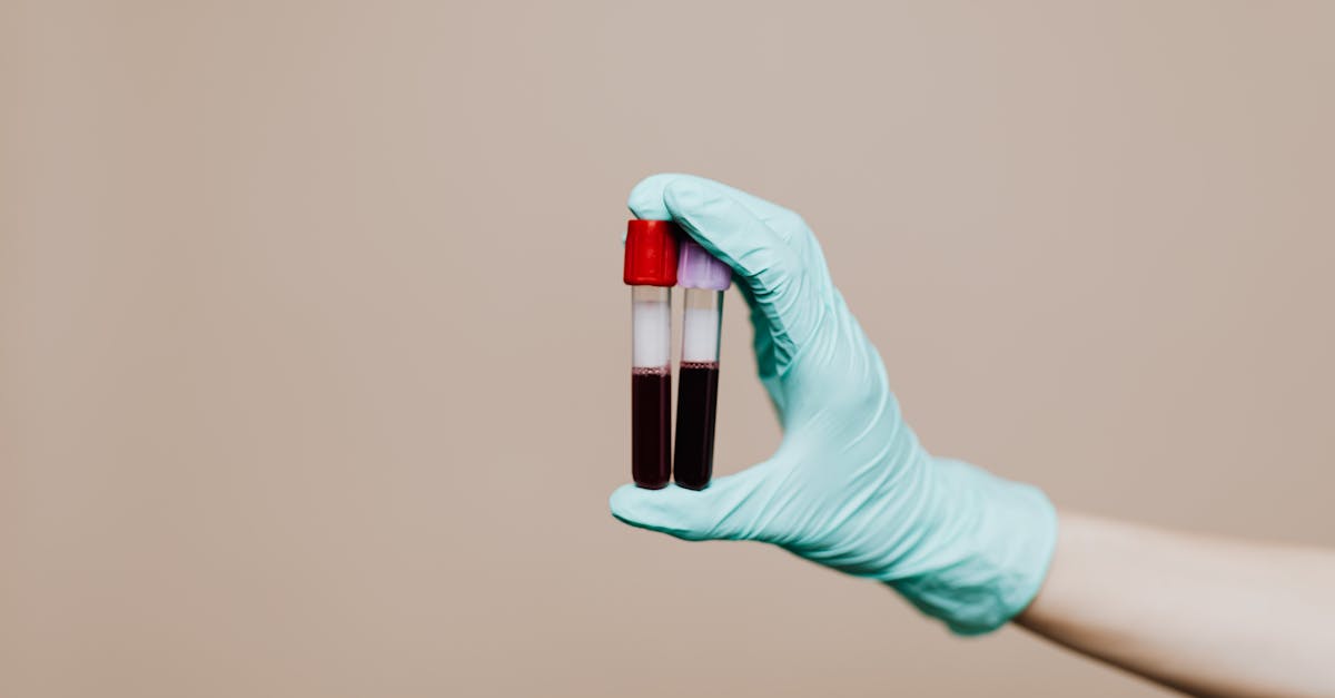 Supplements for Adrenal Fatigue: Likely Root Causes and the Lab Markers Worth Checking
