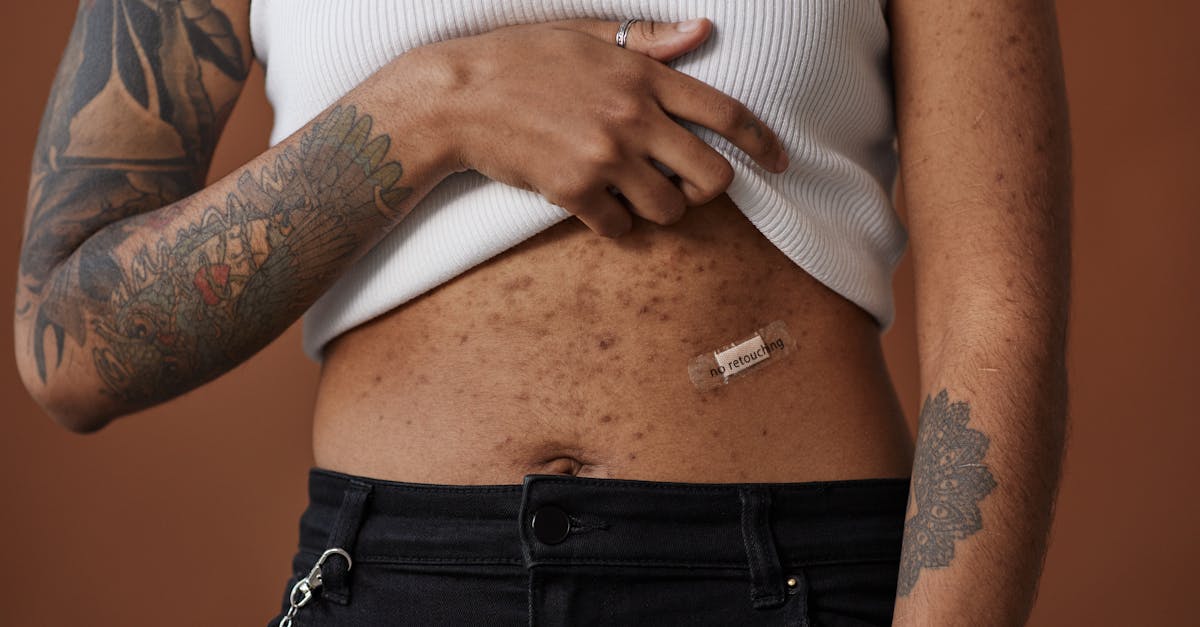 What the Research Actually Says About Supplements for Eczema
