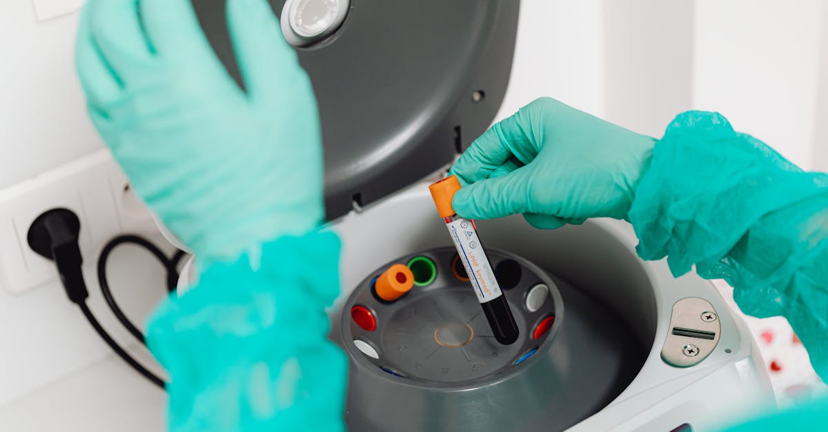 Vitamin B12 Overdose Symptoms: Causes, Lab Markers, and Evidence-Based Supplement Support