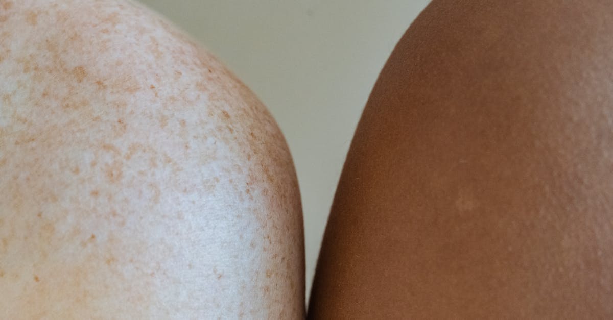 Is Vitamin D3 for Skin Worth Taking? A Look at the Clinical Trials