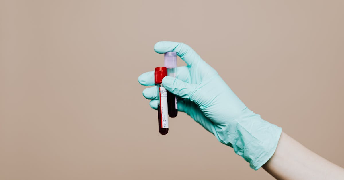 Vitamin K Deficiency Treatment: Causes, Lab Markers, and Evidence-Based Supplement Support